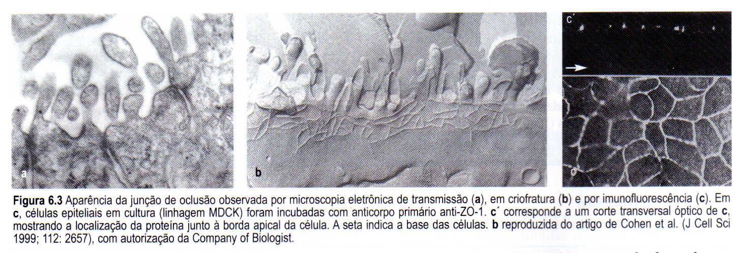 Junção de oclusão 6.