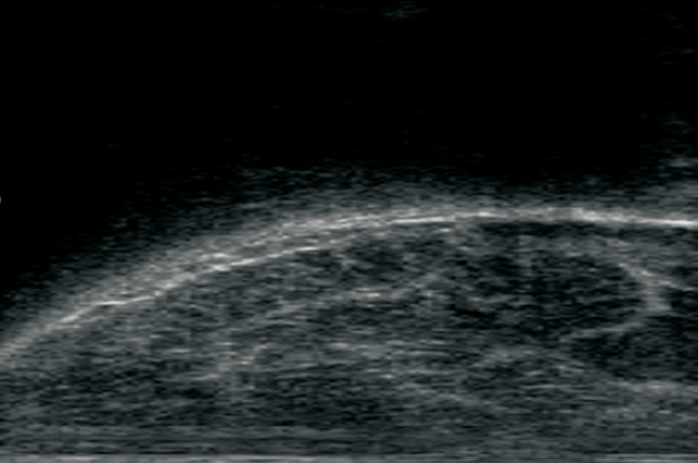 754 Repetibilidade da mensuração de imagens das características de carcaça obtidas por ultrassonografia em fêmeas Nelore Figura 1 - Pontos anatômicos de uma imagem obtida na região entre a 1 a e a 13