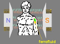 Nanopartículas - Aplicações Biomédicas Ø Ferrofluidos