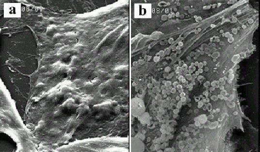 Nanopartículas - Aplicações Biomédicas Marcação de células Ø Pequenas partículas de Fe 3 O 4 (10 nm - micron) Ø