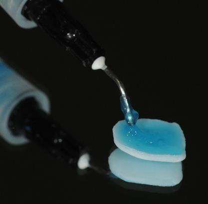 31 Os substratos dentais não foram condicionados com ácido fosfórico por não serem dentes naturais. O sistema adesivo foi aplicado ao dente com o auxílio de um microbrush.
