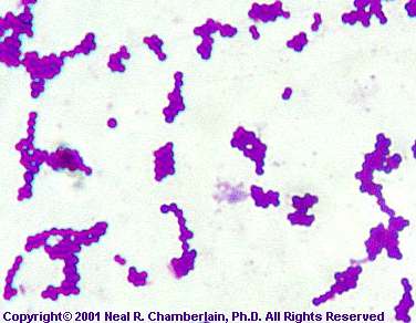 Staphylococcus aureus Klebsiella pneumoniae