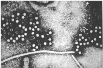 Hepatites A e E Hepatite E Fábio Gregori Taxonomia Características do vírus Não envelopado 27-35 nm diâmetro Fita positiva RNA ~7.2 kb Diagnóstico Diagnóstico Infecção: a) sorodiagnóstico IgM e IgG*.