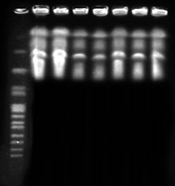 Resultados 61 novamente sepse e evolução para óbito (TABELA 2). As amostras sequenciais da cavidade oral isoladas do neonato P17 com amostra isolada da sepse por C.albicans mostrou o PFGE tipo I.