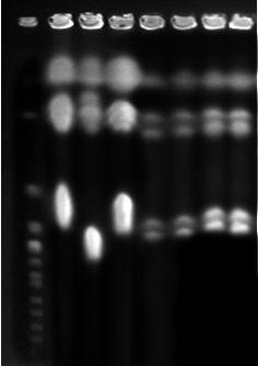 Resultados 63 1 2 3 4 5 6 7 8 1125kb 1020kb 825kb 225kb FIGURA 11. PFGE -tipos das amostras de C. parapsilosis isoladas dos neonatos. 1.Perfil molecular de S. cerevisae; 2.