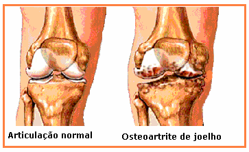 Solução tópica de DICLOFENACO SÓDICO a 1,5% Eficácia e segurança comprovadas no tratamento da osteoartrite primária de joelho, com menor ocorrência de efeitos adversos sistêmicos Doutor O objetivo