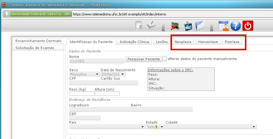 7 STT - Sistema Catarinense de Telemedicina e Telessaúde O último campo a ser preenchido nessa aba é o Tipo de lesão. É possível selecionar um, dois, ou até mesmo os três tipos de lesão.