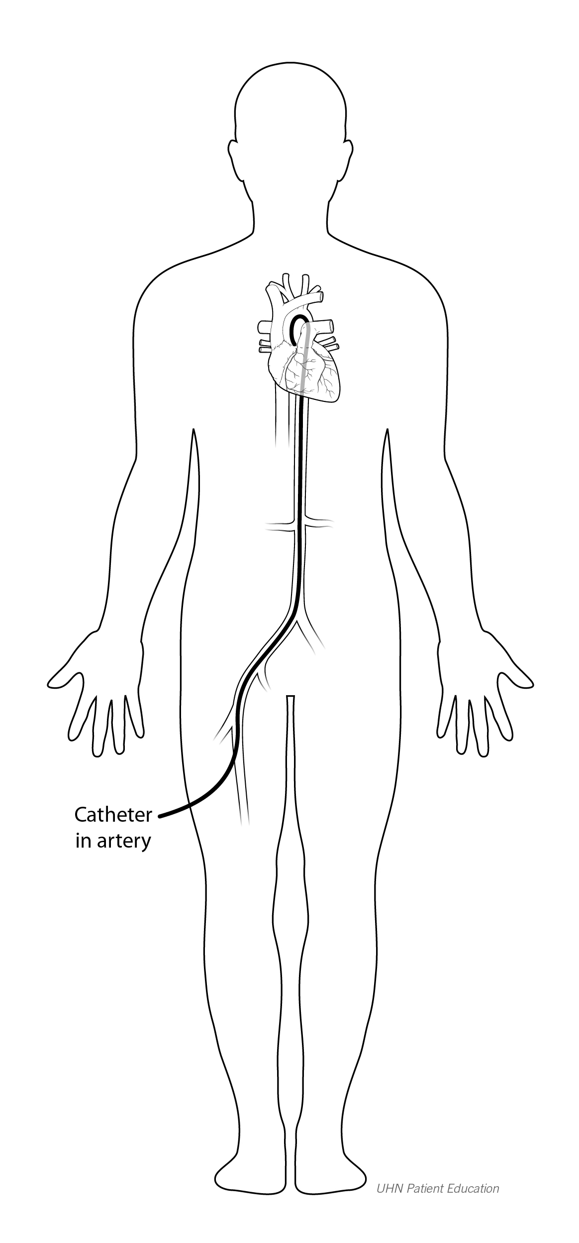 uma esteira ou pedala em uma bicicleta ergométrica, enquanto seu ritmo cardíaco e frequência cardíaca são monitorados por um eletrocardiograma (ECG).