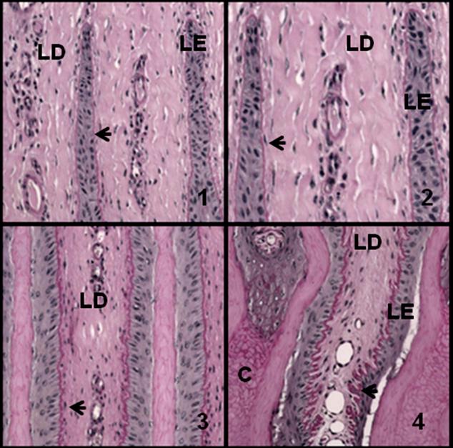 Figura 21- Histologia das lâminas dérmicas e epidérmicas da região dorsal do casco de vaca leiteira evidenciando diferenças quanto às irregularidades da membrana basal (MB) nos terços apical (fotos 1