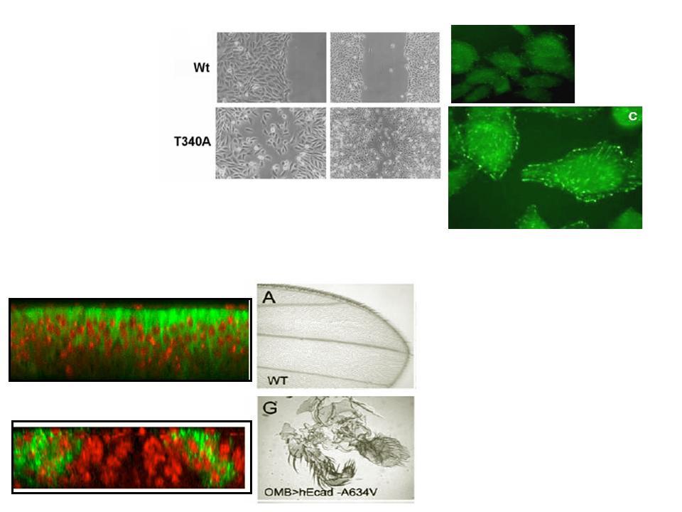 Modelo in vitro Caderina-E normal EGFR normal Caderina-E mutada EGFR