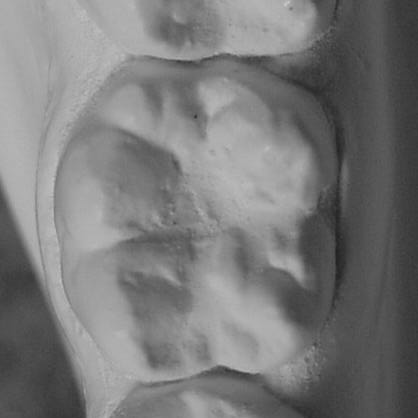 64 CMLD CMVDI CMID CDLD SDVDI FIGURA 9 - Pontos digitalizados na superfície oclusal do primeiro molar inferior direito e ponto