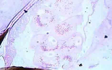 131 A s n v cg B vs v n Figura 4 Células secretoras de indivíduo com 25 dias onde observa-se o início da vacuolização do citoplasma na região central da célula.