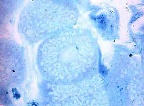 132 A v n B v n * Figura 5 Indivíduos com 56 dias apresentando as células secretoras totalmente vacuolizadas e hipertrofiadas, porém com as vesículas preenchidas por substância formada por