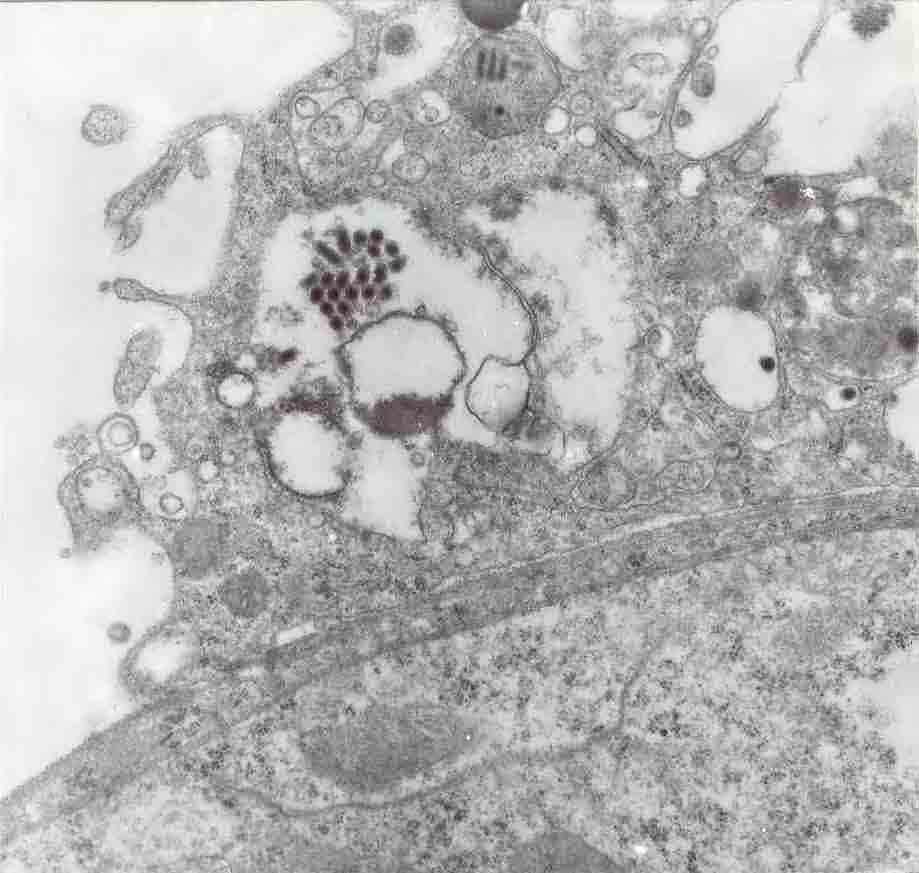 145 A B C v v he ep Figura 2 Em A e B observa-se os Nucleopolyhedrovirus em corte transversal e longitudinal, respectivamente, onde nota-se o envelope viral de baixa eletrondensidade envolvendo cada