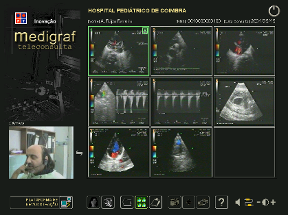 com Kbps bidireccionais e QoS).