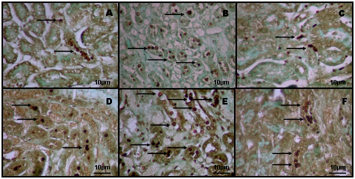 58 Figura 18. Fotomicrografias representativas das células epiteliais pulmonares dos animais do grupo controle (A, B e C) e LPA (D, E e F) analisadas pelo método de TUNEL in situ.