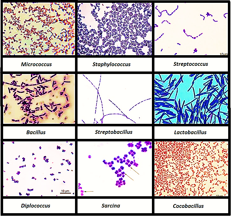 Na Figura 15 está apresentado a visualização microscópica de diversos gêneros de bactérias