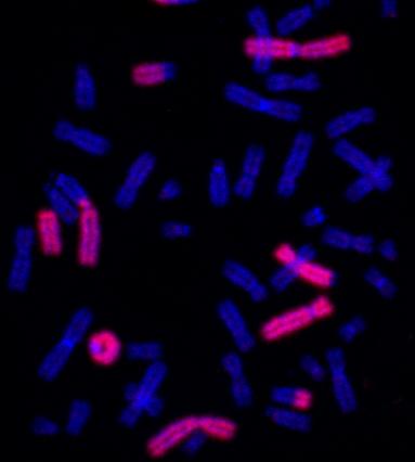 FG Anomalias cromossómicas (%) 30-05-2013 DOSIMETRIA BIOLÓGICA (I) Curva dose-resposta com base na frequência de micronúcleos (MN) induzidos por raios gama em linfócitos humanos MN 7 Curva ajustada a