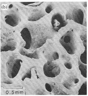 osso trabecular no osso trabecular também podemos estabelecer uma estrutura hierárquica a grande diferença para o osso cortical é a substituição dos osteons pelas trabéculas.