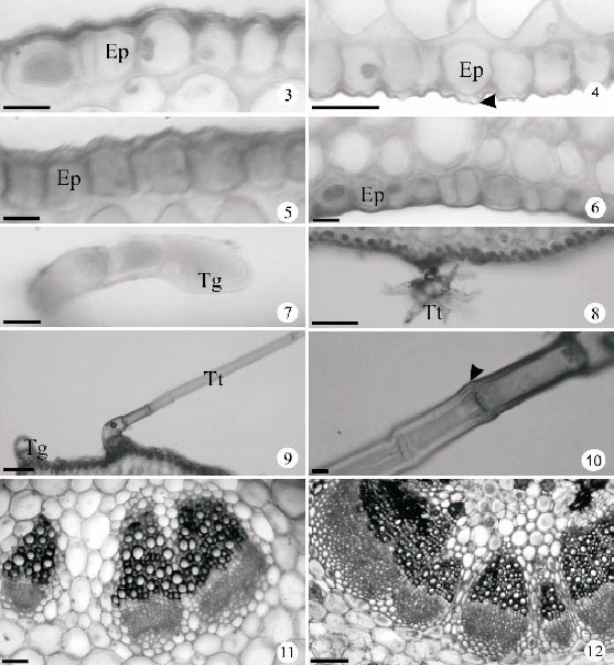 45 FIGURAS 1-2. Diagramas de secções transversais do pecíolo. 1. Gomphrena elegans. 2. Gomphrena vaga. Barras =100 µm. FIGURAS 3-12.