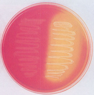 1.2. Estudo Microbiológico * Exame directo microscópico após s coloração de Gram.