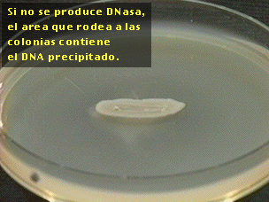 1.2. Estudo Microbiológico * Identificação de S.