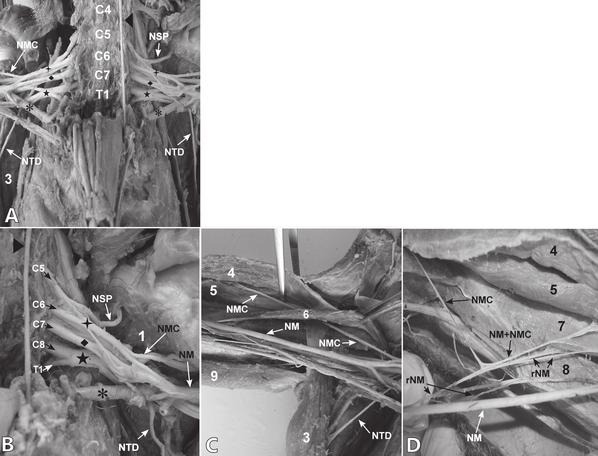 Anatomia do plexo braquial de macaco-barrigudo (Lagothrix lagothricha) 883 Fig.1.