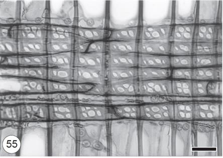 QUESTÃO 35 A figura a seguir é do lenho de Pinus sylvestris. A imagem apresentada é um raio Fonte: IAWA (2004) A) heterogêneo, porque possui traqueídeos e células parenquimáticas.