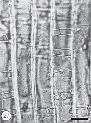 QUESTÃO 50 Na parede celular das células que compõem o lenho das gimnospermas, podem estar presentes algumas modificações como a estrutura indicada pela seta na figura a seguir.