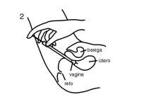 INSTRUÇÕES DE APLICAÇÃO 1. Após a lavagem das mãos, puxe completamente o êmbolo do aplicador até prender. 2. Abra a bisnaga.