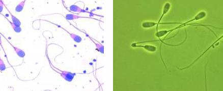 16 3 MORFOLOGIA ESPERMÁTICA Para a avaliação de rotina das características morfológicas dos espermatozoides, podem ser utilizadas duas técnicas: esfregaço corado em microscópio de campo claro e