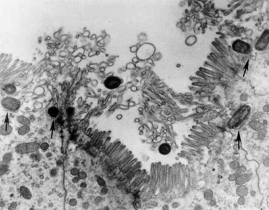 Electron photomicrograph demonstrating invasion of guinea pig ileal epithelial cells by Salmonella Typhimurium.