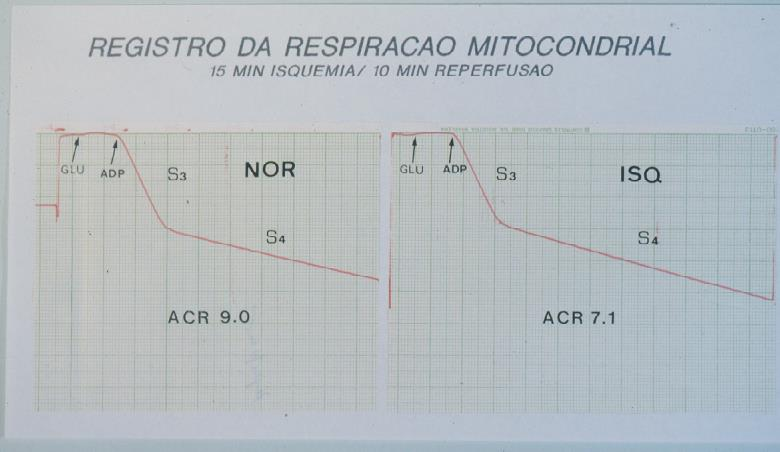 Avaliação da Função Mitocondrial no