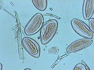 Figura 8. Helmintos que afetaram a população estudada a) Ovo larvado de A. lumbricoides b) Ovo de E.