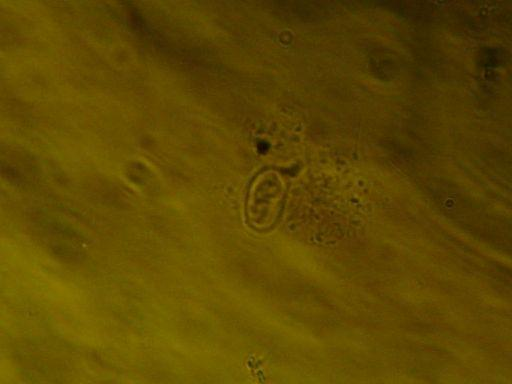 4 Materiais e Métodos 60 Contraste de Fase - Estruturas internas como a presença de sutura e parede para oocistos; para cistos, a presença de axonema, visualização dos núcleos (1 a 4) e parede