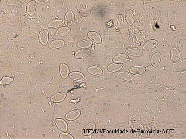 Ovos de Enterobius vermicularis (400X)