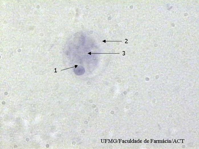 Trofozoíto de Entamoeba histolytica/entamoeba dispar corado pela hematoxilina férrica, caracterizado pela presença de um