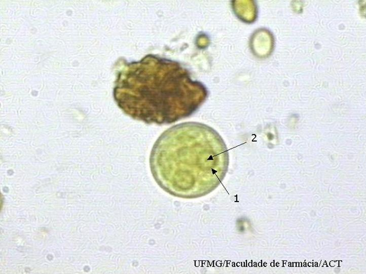 Cisto de Entamoeba histolytica/entamoeba dispar (1000X) corado pelo lugol,