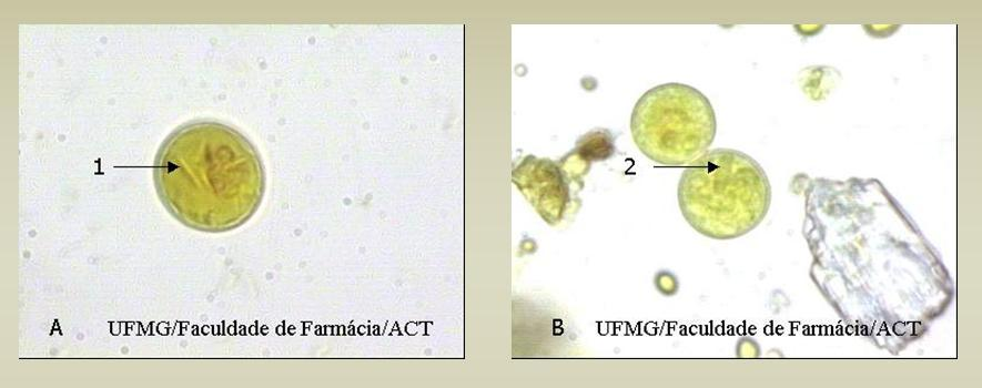 Figura A mostrando cisto com corpo cromatóide em forma de agulha(1) que caracteriza a Entamoeba coli e Figura B