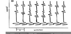 METODOLOGIA A técnica GPR (Ground Penetrating Radar) ou Radar de Penetração no Solo ou Georadar - utiliza ondas eletromagnéticas de altas freqüências (ondas de rádio), na faixa de 10 a 1000 MHz