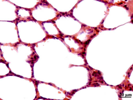 28 SHAM IR IPC NAC Figura 5 Fotomicrografias mostrando parte do pulmão de ratos pertencentes aos vários grupos de estudo. Notar no grupo IR região de alvéolos alterados. H.E.