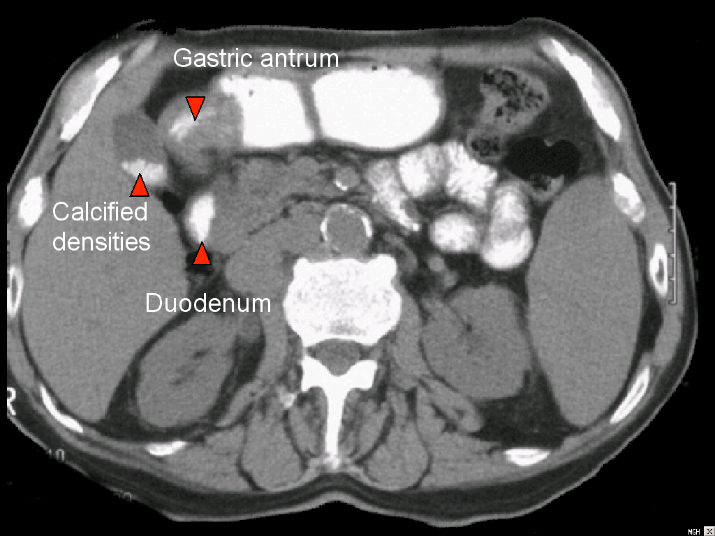 Serviço de Radiologia