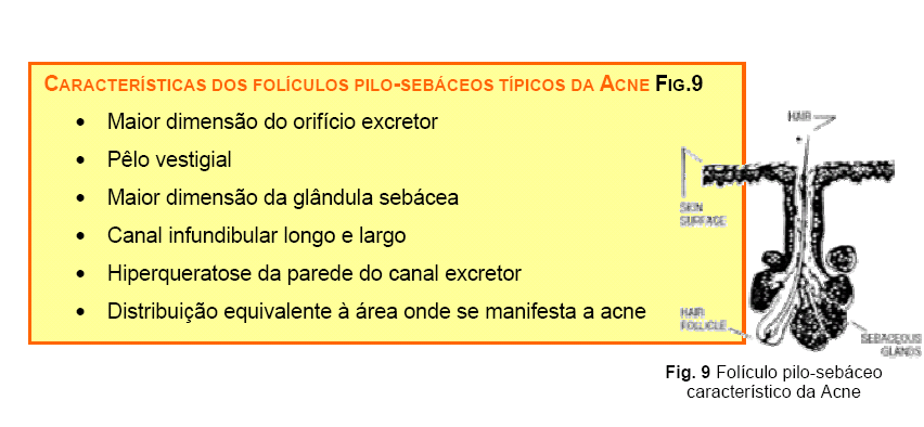 > acne nódulo-quística: forma mais intensa, em que há coexistência de quistos sebáceos simples ou inflamatórios e purulentos.