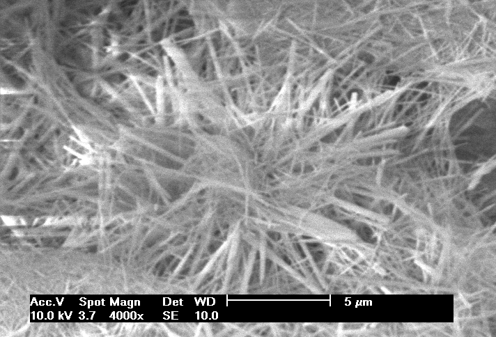 40 Figura 4-1 Imagem das partículas de Hidroxiapatita obtidas por microscopia eletrônica de varredura. Figura 4-2 - Imagem das fibras de Hidroxiapatita obtidas por microscopia eletrônica de varredura.