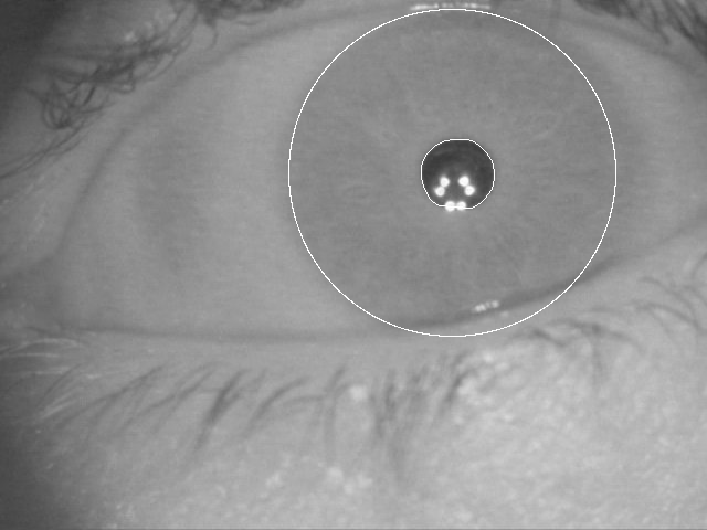 44 passo anterior. Este procedimento foi adotado devido a constatação de que o centro da pupila está normalmente deslocado de 0.1 cm até 0.