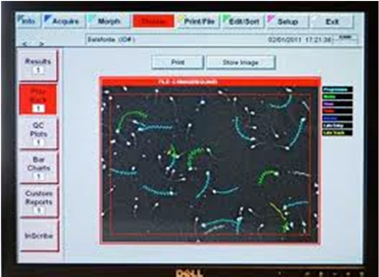 CASA-Computer Assisted Sperm Analysis Motilidade Total (%), Motilidade Progressiva (%) Velocidade de Trajeto (VAP, μm/s) Velocidade Progressiva (VSL, μm/s) Velocidade Curvilinear(VCL, μm/s)