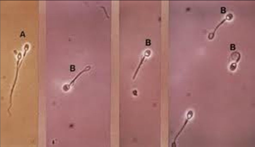 Métodos de Avaliação de Sêmen Testes de Viabilidade de membrana: Teste Hiposmótico: em uma solução hiposmótica(150 mosm) a água entra no espermatozoide na tentativa de se alcançar o