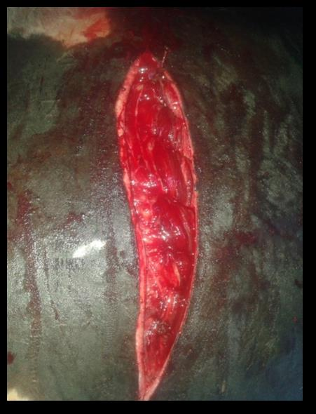 Para a rafia da cavidade abdominal, a sutura interna foi realizada com ponto continuo simples com sutura única, alcançando os quatro músculos e as bainhas (figura 4), com fio absorvível