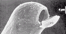 FRÇÃ D ÓPR IP DE cariogamia gametângios plasmogamia meiose mitose 1. scos unitunicados operculados inoperculados 2. scos bitunicados www.apsnet.org/.../photos-d/ascomycetes.