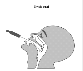 Swab de orofaringe Colher swab na área posterior da faringe e tonsilas, evitando tocar na língua.